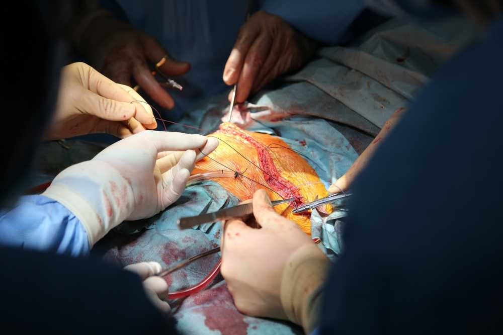 Nhung-hinh-anh-dac-biet-ve-ca-ghep-phoi-thanh-cong-dau-tien