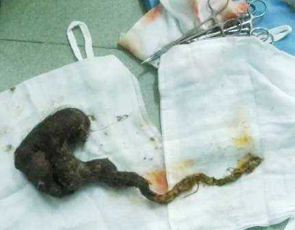 toc-may-1488257796291