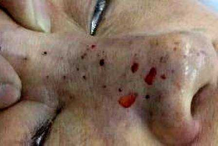 lam-dep-1489562633912