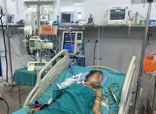 ghepgan-5750-1490069081