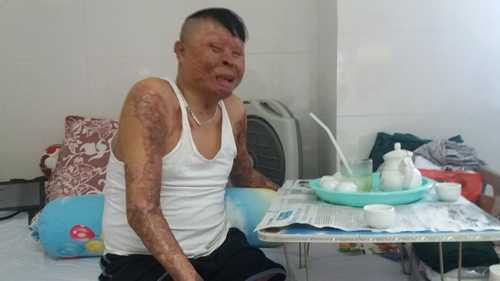 chien si duy nhat con song sau vu roi may bay o hoa lac sap ra vien hinh anh 1