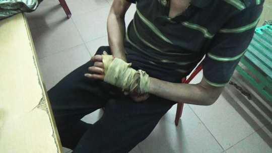 Mọi thủ đoạn hoá trang thành người bị bệnh tật đã bị lộ diện