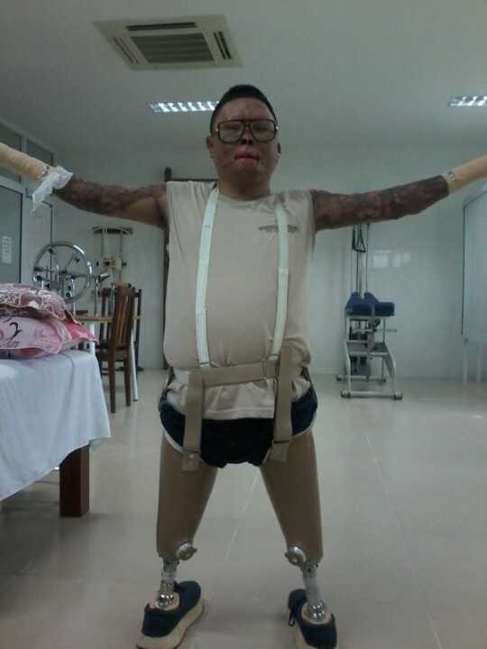 891 ngày đêm của chiến sĩ sống sót sau vụ rơi trực thăng ở Hòa Lạc - ảnh 3