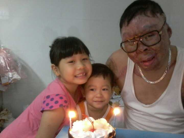 891 ngày đêm của chiến sĩ sống sót sau vụ rơi trực thăng ở Hòa Lạc - ảnh 4