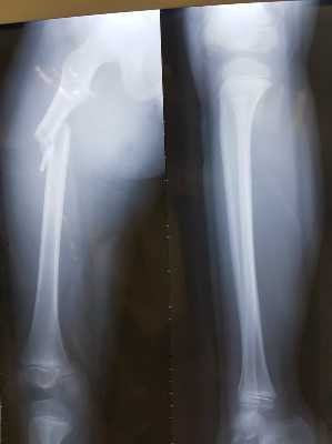 phu-huynh-buc-xuc-vi-hieu-truong-bung-bit-chuyen-hoc-sinh-gay-chan