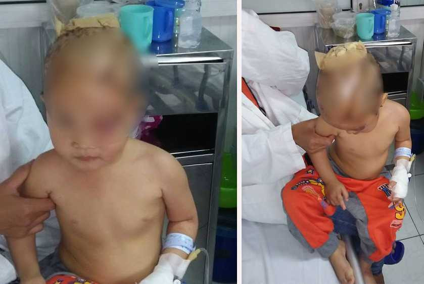 chau-be-bi-cho-can22222222-1601