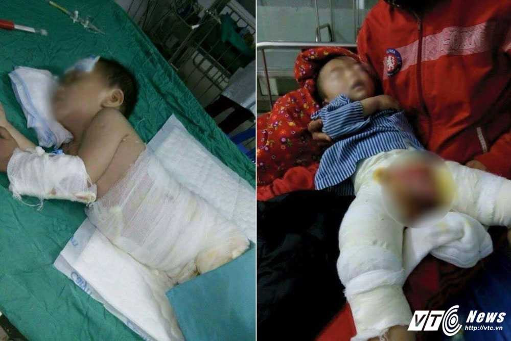 chau-be-bi-bong-1-0929