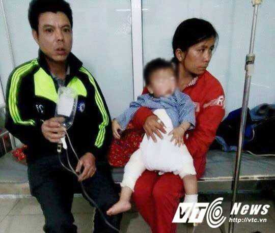 chau-be-bi-bong-2-0929