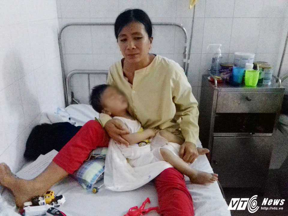 chau-be-bi-bong-4-0930