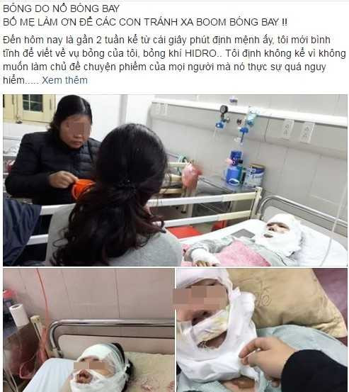9X bi bong mat do no bong bay: Toi muon canh bao moi nguoi hinh anh 1