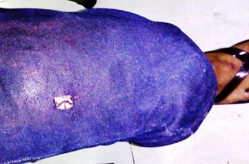 huc-vang-nhom-canh-sat-tp-hcm-tai-xe-xe-thuoc-la-tu-vong