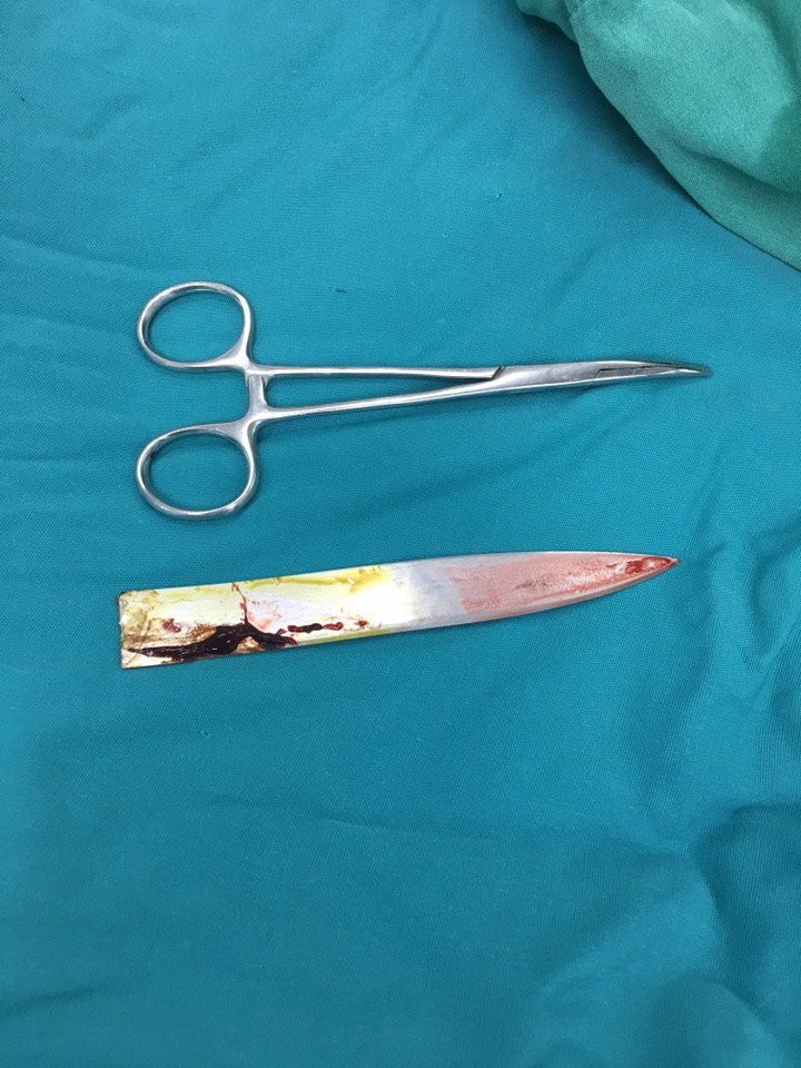 Bị 4 kẻ cầm dao truy sát khi đang đi chơi với bạn gái ảnh 1