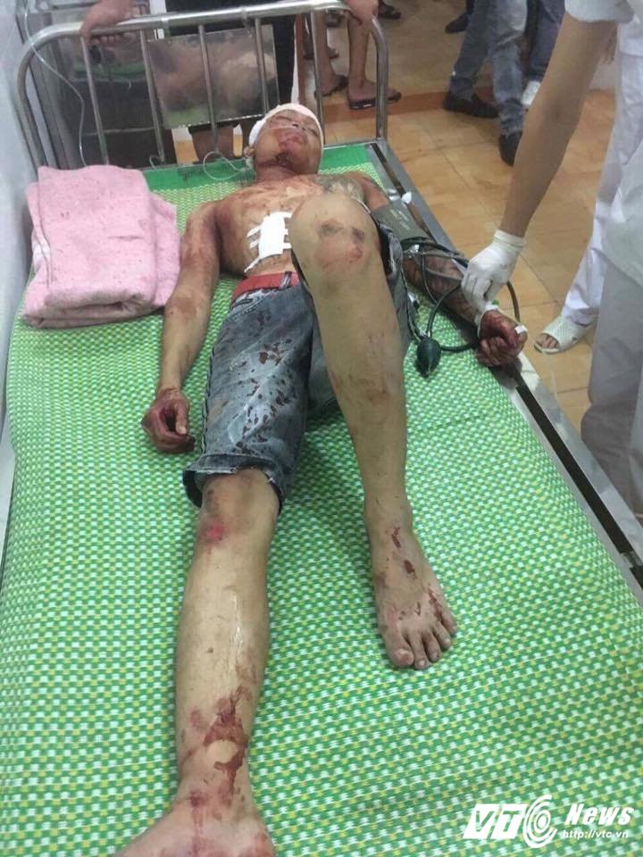 20228930_1415499875210176_5711277109165393553_n