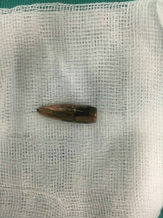 Nguoi phu nu ke phut bi dan lac gam trung nguc hinh anh 2