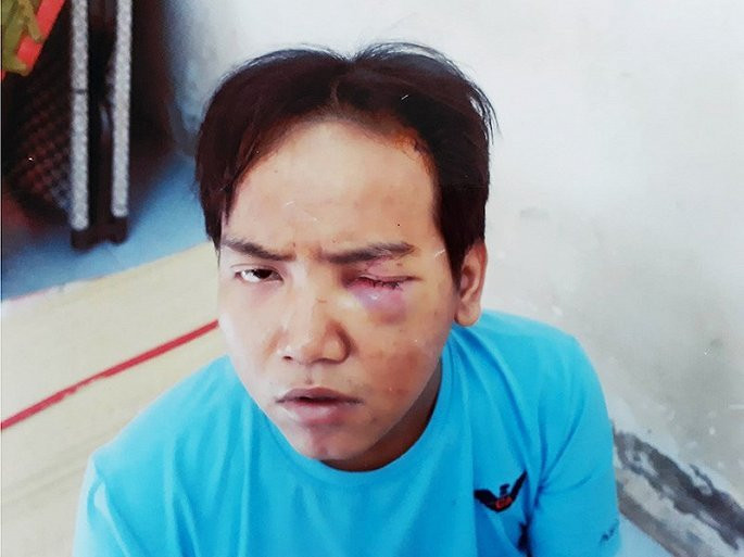 loi-khai-cua-ke-tam-than-cat-co-be-trai-6-tuoi_kjjr-0710340 3