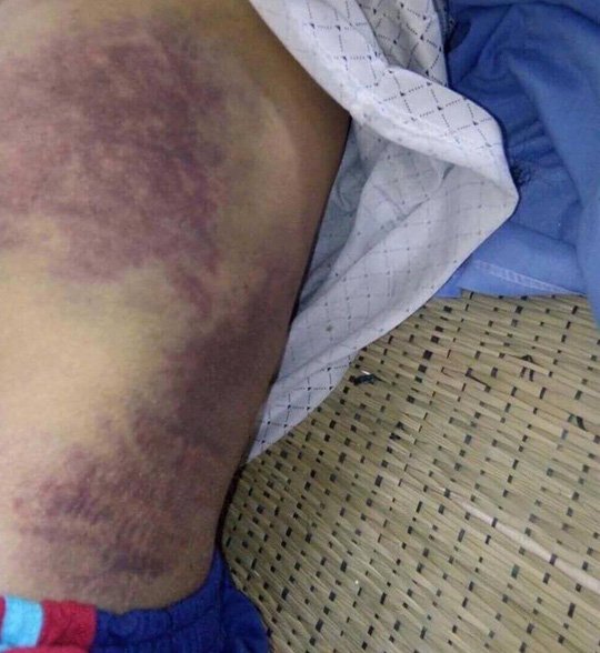Con trai đánh bố đẻ gãy xương sườn, mẻ xương bánh chè, xương ống chân - Ảnh 3.