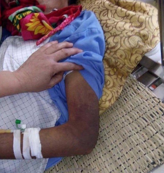 Con trai đánh bố đẻ gãy xương sườn, mẻ xương bánh chè, xương ống chân - Ảnh 1.