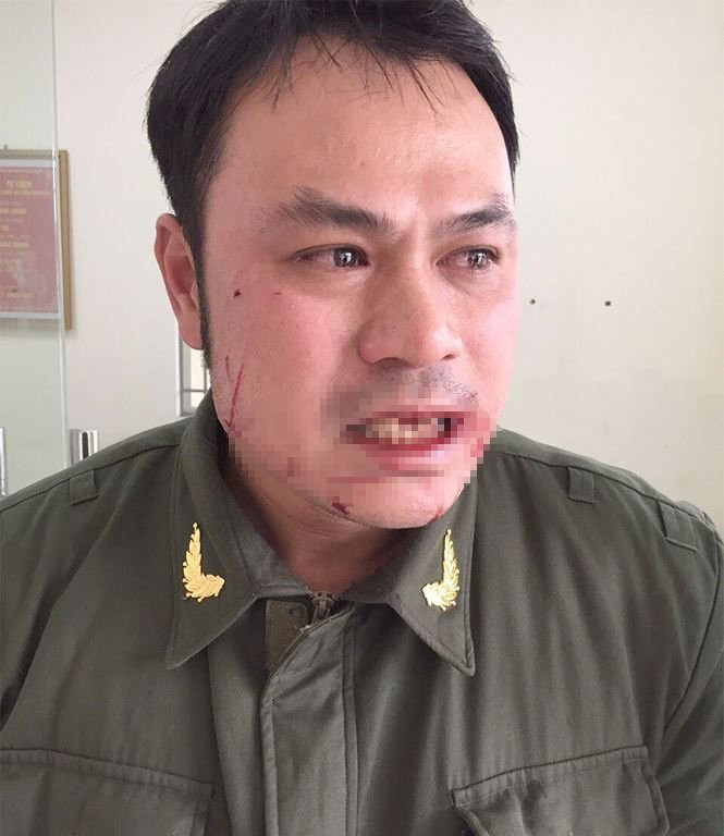 nhan_vien_an_ninh_bi_hanh_hung_tien_phong_rlhz