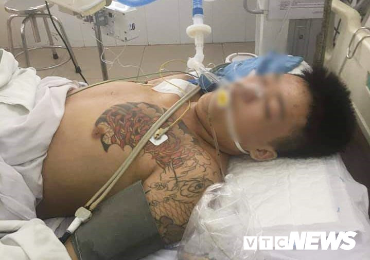 Anh-bi-can-nhap-vien