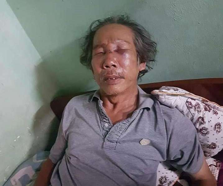 26229461_863749410474062_346580108505644262_n