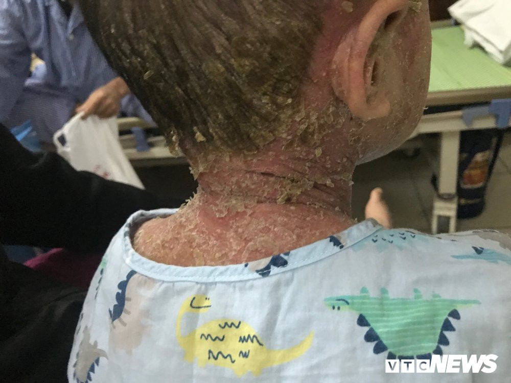 bong vay toan than 3