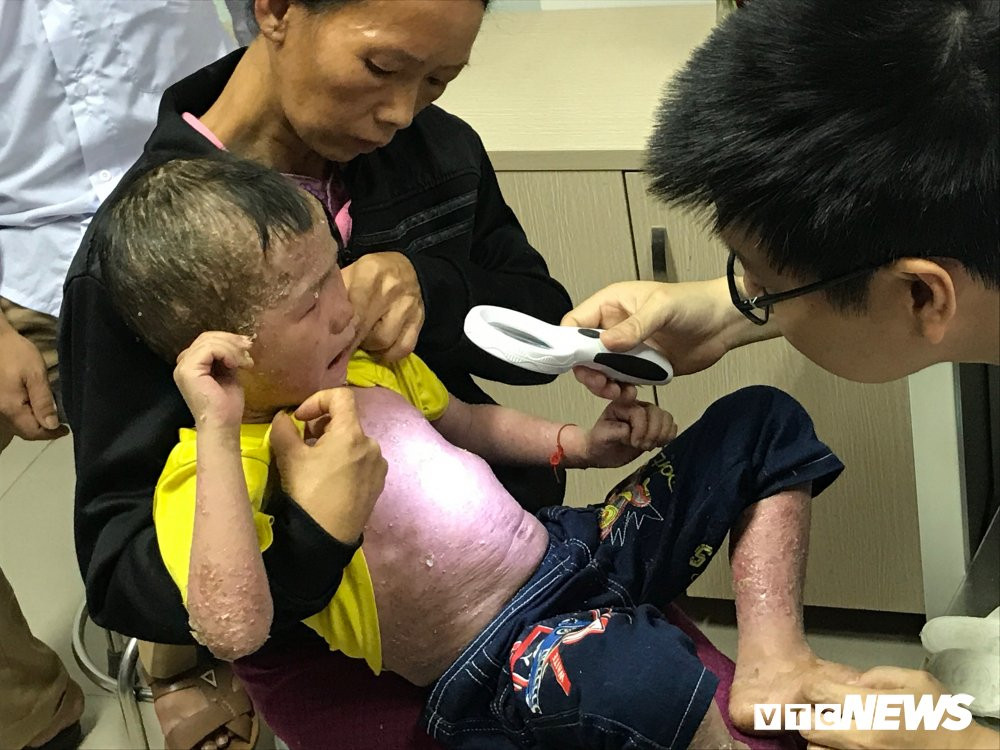 tieng khoc benh nhi vay nen