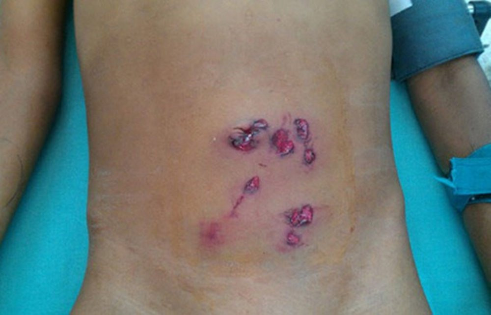 zing - nhiem trung 4