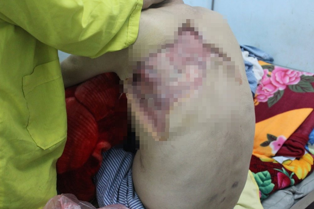 bien chung tieu duong 3 so y te ha giang 8