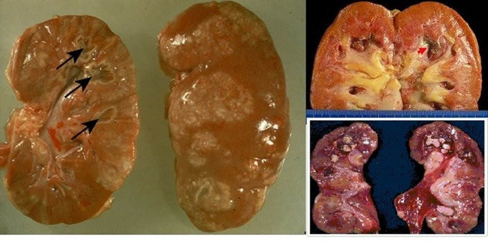 bien chung tieu duong 4 infonet 6
