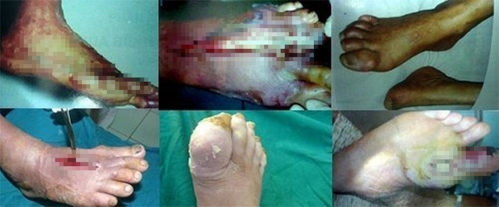 bien chung tieu duong 5 infonet 14