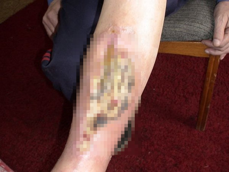 bien chung tieu duong 7 thuc duong 13