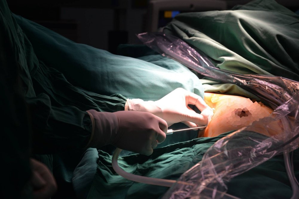 noi soi tuyen giap 1 lo