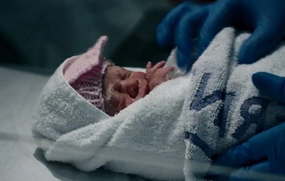 em be ra doi sau sinh mo