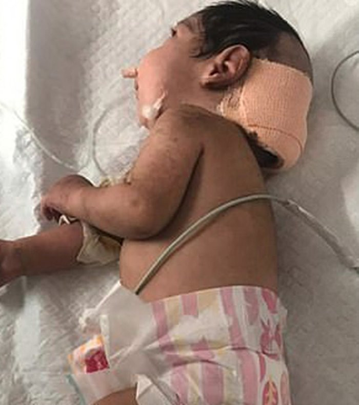 be trai sau khi duoc cuu song