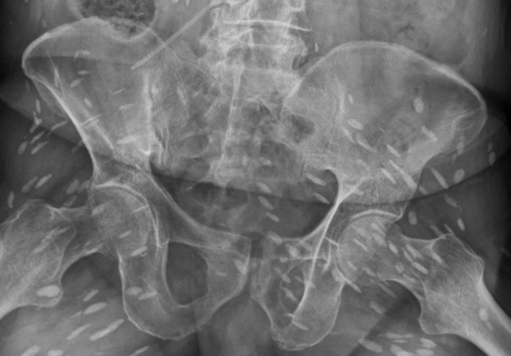 hinh anh phim chup san lon