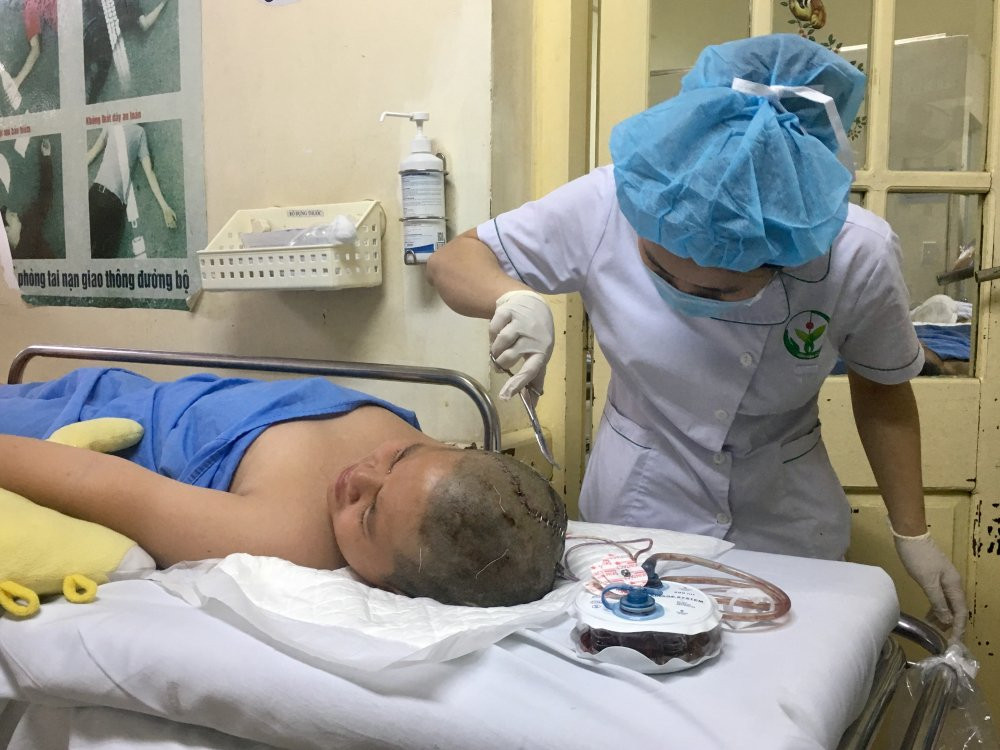 nam sinh bi sao roi cam vao dau