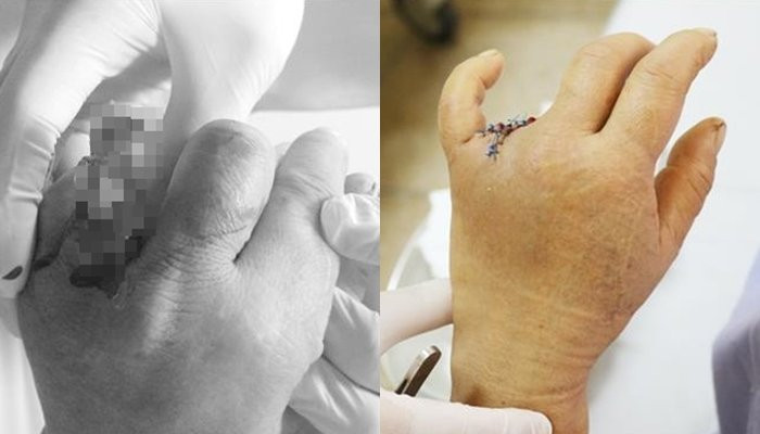 mat ngon tay vi nhan mac vao dinh oc