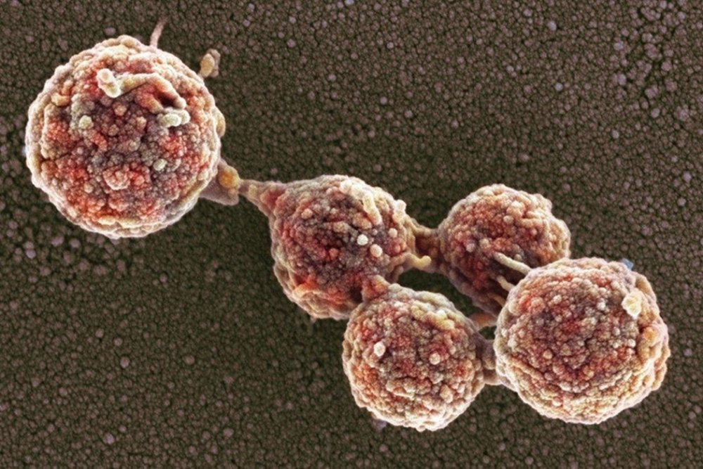 lap trinh vi khhuan 1