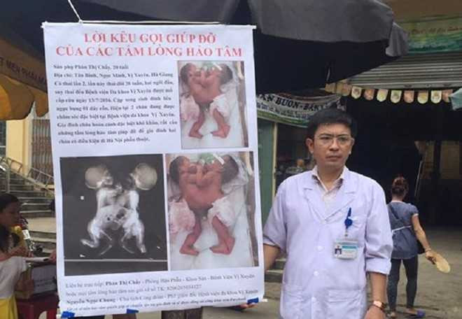 Bac si ra cho keu goi cuu hai be dinh lien: 'Toi da lam can' hinh anh 1