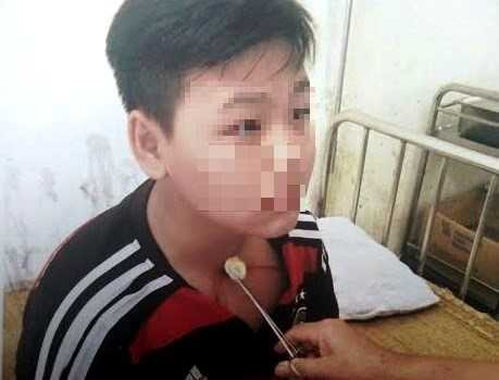 Thay giao tat, da vao bung nam sinh lop 8 hinh anh 1