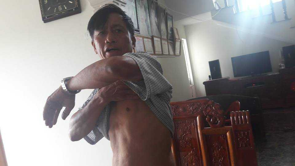 15202702_1103839206397896_7519173145524099540_n