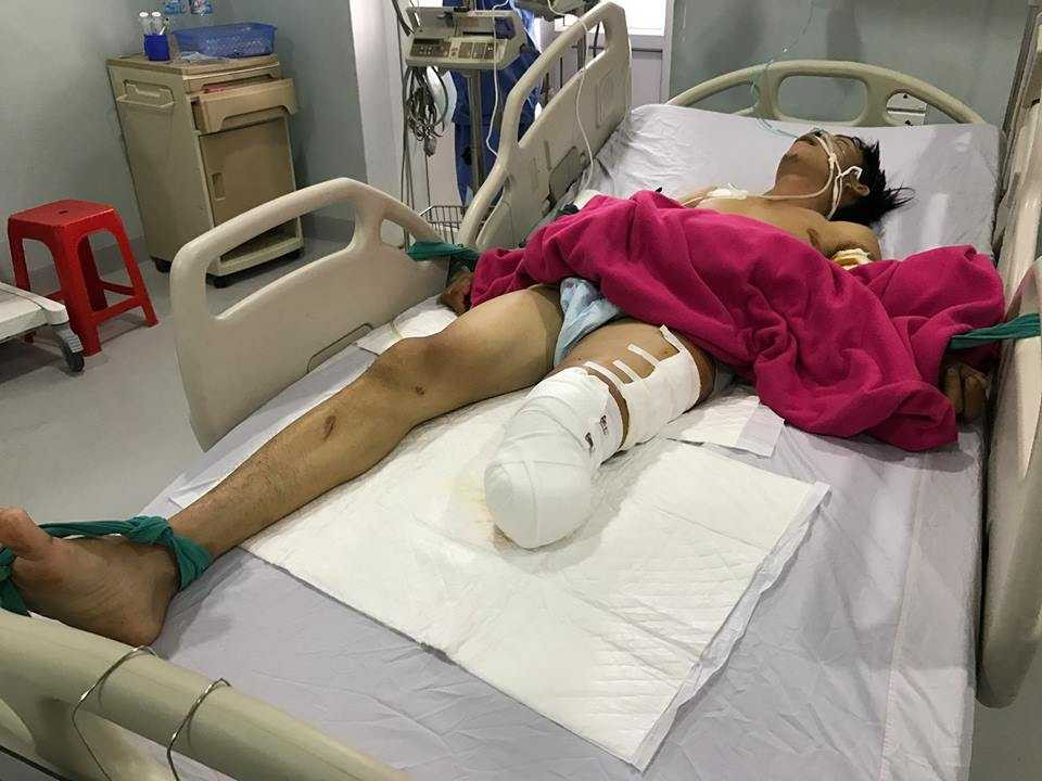 16559042_1242309109215898_716758102_n