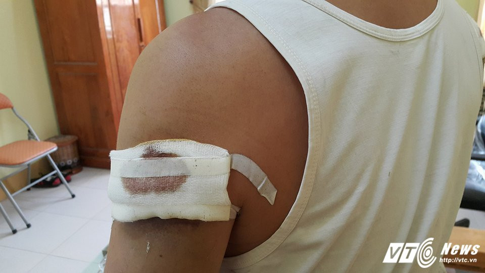 23584489_2574949509312423_2133739991_n 4