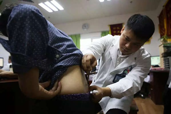 nguoi-trung-quoc-chiu-ong-dot-de-chua-benh-3 4