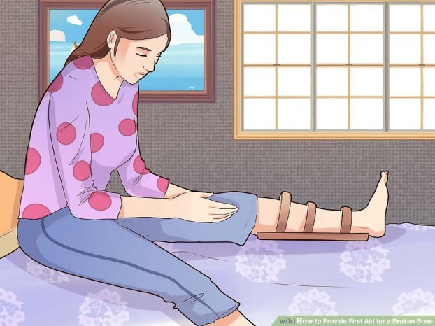 Kỹ năng sơ cứu: Cách sơ cứu khi bị gãy xương nhanh và an toàn nhất 4