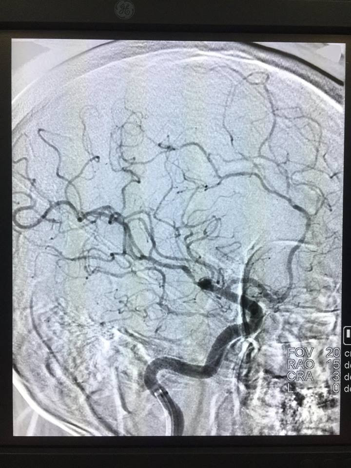 17629924_806929939464466_3270450052784321531_n