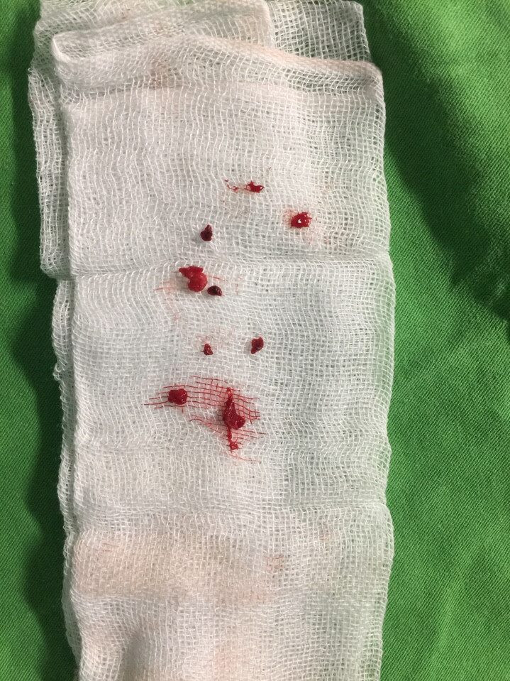 17690679_1475776369108433_433364283_n