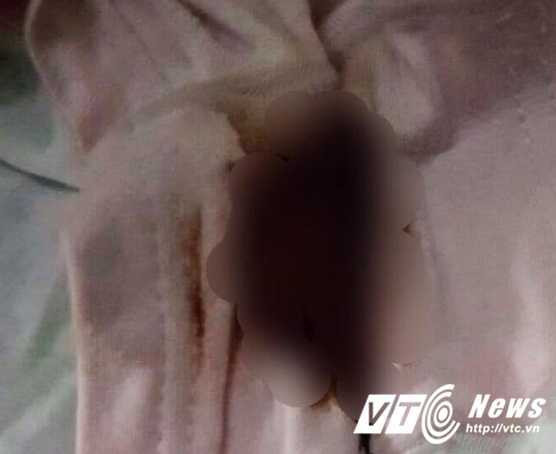 17310444_1238018209652716_2001521323_o