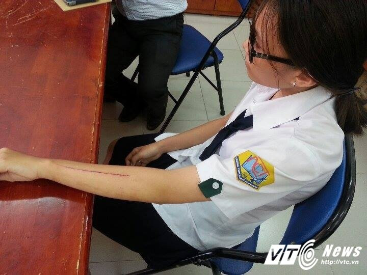 Hinh anh Thuc hu vu nu sinh lop 10 bi ban dung luoi lam rach tay