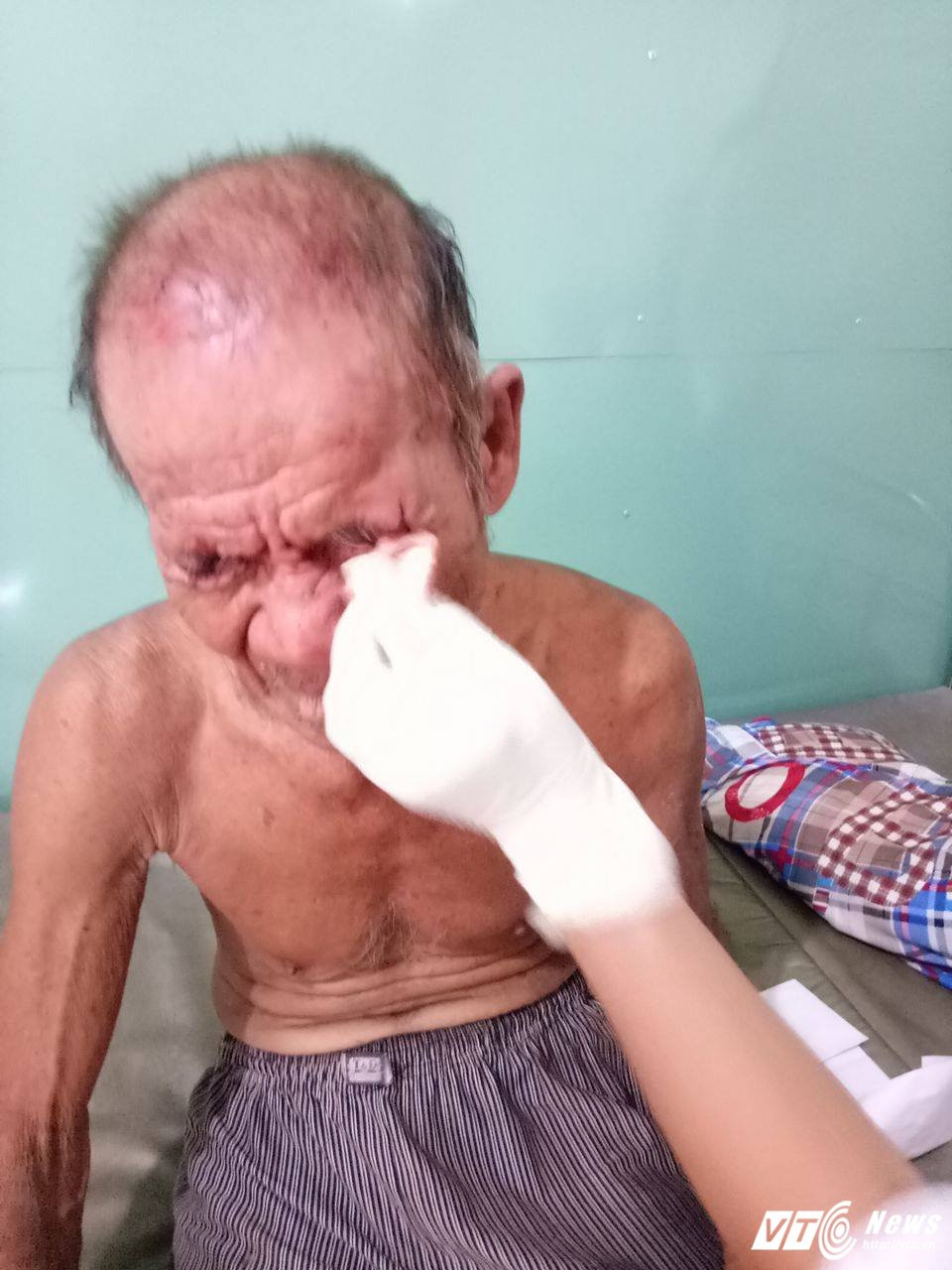 Hinh anh Nghich tu danh cha nhap vien o Binh Duong: Sang hat chen com, danh sung dau; chieu lai vac dao doi chem cha